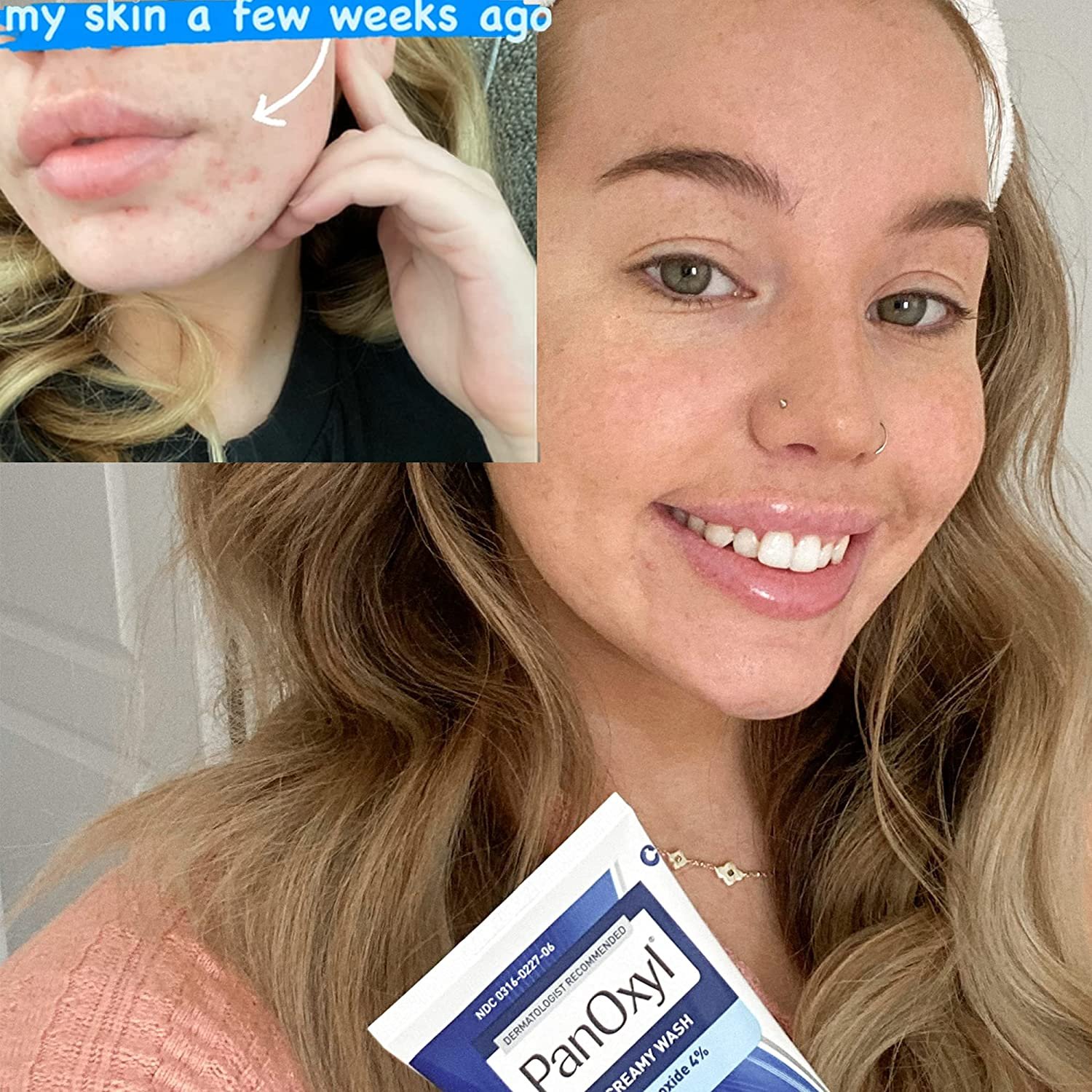 PanOxyl - Acne Creamy Wash Benzoyl Peroxide 4% Daily Control - Image 4